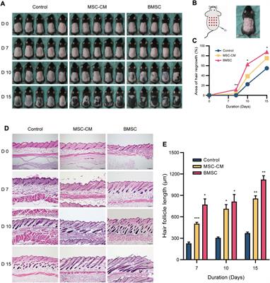 TMT-Based Quantitative Proteomic Analysis Reveals the Effect of Bone Marrow Derived Mesenchymal Stem Cell on Hair Follicle Regeneration